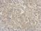 Ribonuclease A Family Member 11 (Inactive) antibody, NBP2-20172, Novus Biologicals, Immunohistochemistry paraffin image 