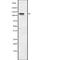 Protein Phosphatase 1 Regulatory Subunit 13B antibody, abx148266, Abbexa, Western Blot image 