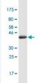 Tight Junction Protein 2 antibody, H00009414-M01-100ug, Novus Biologicals, Western Blot image 