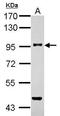 Transforming Growth Factor Beta Receptor 3 antibody, TA308670, Origene, Western Blot image 
