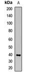 2'-5'-Oligoadenylate Synthetase 1 antibody, LS-C667654, Lifespan Biosciences, Western Blot image 