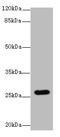 Transmembrane Protein 217 antibody, A61398-100, Epigentek, Western Blot image 