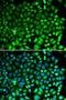Proteasome Subunit Beta 2 antibody, LS-C748673, Lifespan Biosciences, Immunofluorescence image 