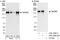 WD Repeat Domain 62 antibody, A301-560A, Bethyl Labs, Western Blot image 