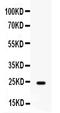 Fibroblast Growth Factor 1 antibody, PB9944, Boster Biological Technology, Western Blot image 