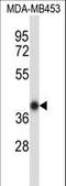 Homeobox C11 antibody, LS-C164410, Lifespan Biosciences, Western Blot image 