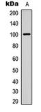 Inter-Alpha-Trypsin Inhibitor Heavy Chain 3 antibody, LS-C354402, Lifespan Biosciences, Western Blot image 