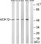 Cholinergic Receptor Nicotinic Alpha 10 Subunit antibody, TA315639, Origene, Western Blot image 