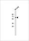 Matrix Metallopeptidase 14 antibody, A00656, Boster Biological Technology, Western Blot image 