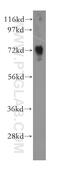 Nudix Hydrolase 6 antibody, 11181-1-AP, Proteintech Group, Western Blot image 