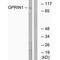 G Protein Regulated Inducer Of Neurite Outgrowth 1 antibody, PA5-50034, Invitrogen Antibodies, Western Blot image 