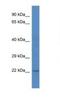 Chromosome 1 Open Reading Frame 216 antibody, NBP1-74251, Novus Biologicals, Western Blot image 