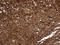 Drebrin 1 antibody, LS-C796265, Lifespan Biosciences, Immunohistochemistry paraffin image 