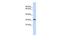 KLF14 antibody, GTX49074, GeneTex, Western Blot image 