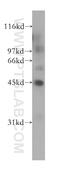 Indian Hedgehog Signaling Molecule antibody, 13388-1-AP, Proteintech Group, Western Blot image 