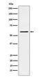 P21 (RAC1) Activated Kinase 1 antibody, M00454, Boster Biological Technology, Western Blot image 