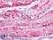 Parathyroid Hormone 1 Receptor antibody, LS-A761, Lifespan Biosciences, Immunohistochemistry frozen image 