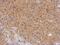 Cyclin Dependent Kinase 16 antibody, NBP2-19732, Novus Biologicals, Immunohistochemistry paraffin image 