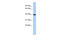 Glutaredoxin 3 antibody, 27-200, ProSci, Western Blot image 