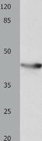 Potassium Voltage-Gated Channel Subfamily A Member 5 antibody, TA323044, Origene, Western Blot image 