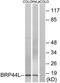 Mitochondrial Pyruvate Carrier 1 antibody, TA315496, Origene, Western Blot image 