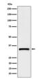 Complement C1q Binding Protein antibody, M01439-1, Boster Biological Technology, Western Blot image 
