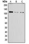 ATPase Sarcoplasmic/Endoplasmic Reticulum Ca2+ Transporting 1 antibody, MBS821566, MyBioSource, Western Blot image 