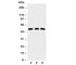 Interleukin 1 Receptor Associated Kinase 4 antibody, R31042, NSJ Bioreagents, Western Blot image 