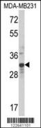 MAX Dimerization Protein MLX antibody, MBS9201632, MyBioSource, Western Blot image 