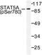 Signal Transducer And Activator Of Transcription 5A antibody, LS-C177957, Lifespan Biosciences, Western Blot image 