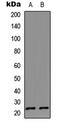 Interleukin 17D antibody, LS-C356121, Lifespan Biosciences, Western Blot image 