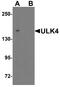 Unc-51 Like Kinase 4 antibody, A08552, Boster Biological Technology, Western Blot image 