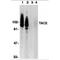 ADAM Metallopeptidase Domain 17 antibody, MBS150091, MyBioSource, Western Blot image 