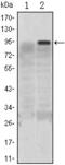 Kruppel Like Factor 4 antibody, GTX82771, GeneTex, Western Blot image 