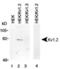 Potassium Voltage-Gated Channel Subfamily A Member 2 antibody, PA5-23011, Invitrogen Antibodies, Western Blot image 