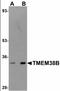 Transmembrane Protein 38B antibody, orb94349, Biorbyt, Western Blot image 