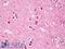 Ribosomal Protein S6 Kinase A5 antibody, LS-B8032, Lifespan Biosciences, Immunohistochemistry paraffin image 