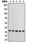Protein Kinase CAMP-Dependent Type I Regulatory Subunit Beta antibody, orb214439, Biorbyt, Western Blot image 