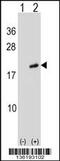 ADP Ribosylation Factor Like GTPase 2 antibody, 58-621, ProSci, Western Blot image 
