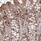 NAD Synthetase 1 antibody, NBP2-58373, Novus Biologicals, Immunohistochemistry paraffin image 