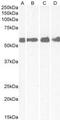 Corticotropin Releasing Hormone Receptor 1 antibody, MBS421554, MyBioSource, Western Blot image 