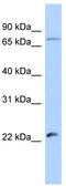 Heat Shock Transcription Factor Y-Linked 2 antibody, TA339922, Origene, Western Blot image 