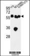 Lectin, Mannose Binding 1 antibody, LS-C165804, Lifespan Biosciences, Western Blot image 