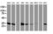 Lactamase Beta 2 antibody, LS-C785780, Lifespan Biosciences, Western Blot image 