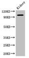 AP2 Associated Kinase 1 antibody, CSB-PA643571LA01HU, Cusabio, Western Blot image 