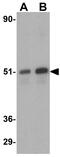 Death Associated Protein Kinase 3 antibody, GTX22057, GeneTex, Western Blot image 