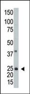 ADP Ribosylation Factor Like GTPase 3 antibody, PA5-12113, Invitrogen Antibodies, Western Blot image 