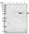 ST3 Beta-Galactoside Alpha-2,3-Sialyltransferase 5 antibody, NBP2-32612, Novus Biologicals, Western Blot image 