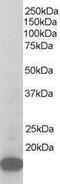 Actin Related Protein 2/3 Complex Subunit 3 antibody, PA1-32486, Invitrogen Antibodies, Western Blot image 