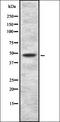 Heterogeneous Nuclear Ribonucleoprotein H1 antibody, orb337463, Biorbyt, Western Blot image 